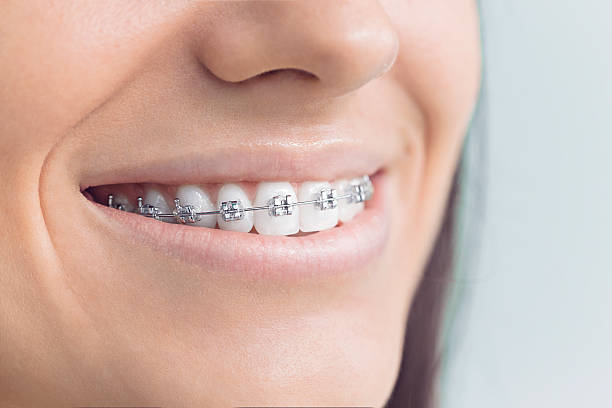 Best Invisalign and Clear Aligners  in Green Park, MO